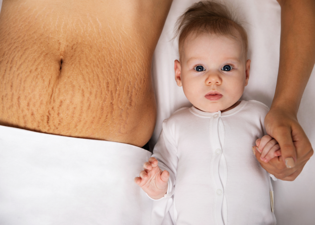 new mom with stretch marks lying next to baby